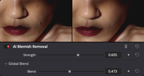 AI Blemish Removal
