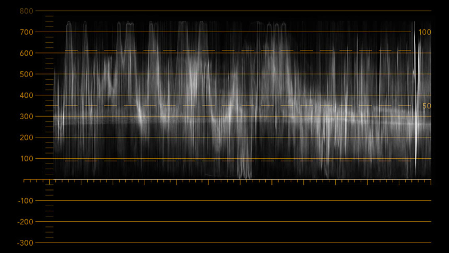 Waveform Spectrum Display Types SmartView – Scopes | Blackmagic Design
